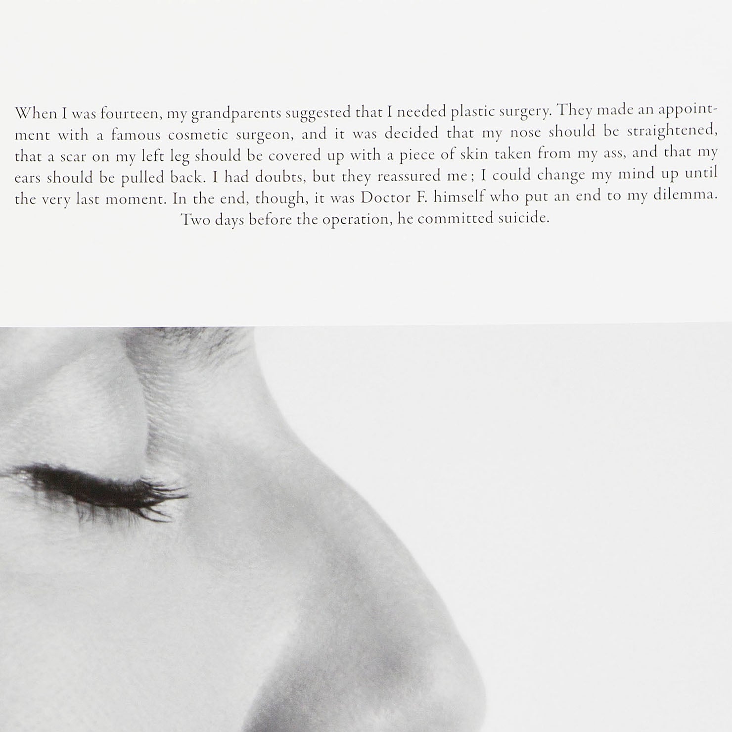 Sophie Calle - Plastic Surgery | Le Nez (English)